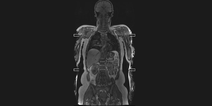 Functional and whole body MRI