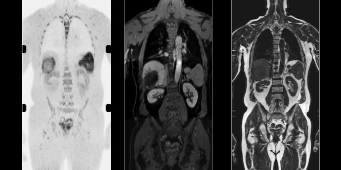 Funktional and whole body MRI 690x345.jpg