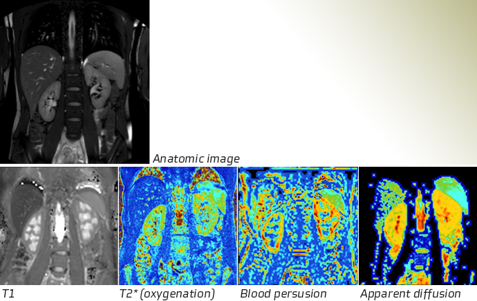 Multiparametrisk kidney function.jpg