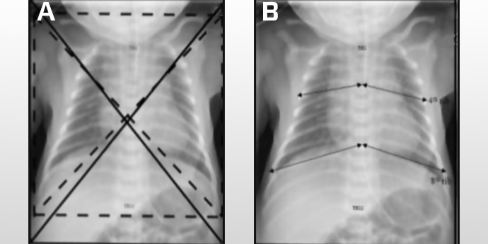 Thorax Illustration.jpg