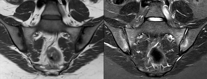 Load-related changes after pregnancy 690x264.jpg