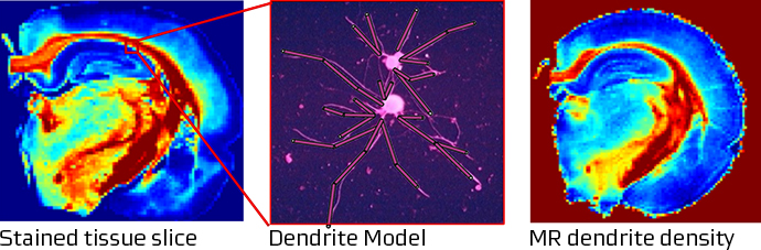 Characterizing Tissue Microstructure by MR-The virtual biops.jpg