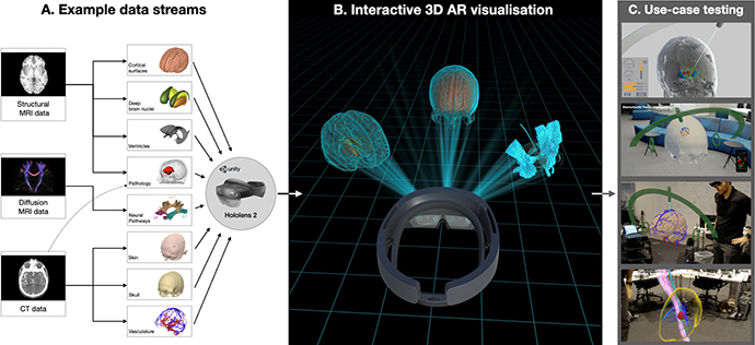 HoloLab_Advancing presurgical planning using holographic visualisations.jpg