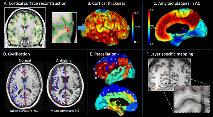 Image Modelling and Dementia research.jpg