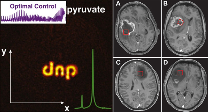 Localized MR spectroscopy.jpg